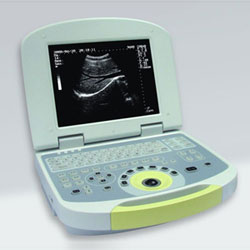 Digital Laptop Ultrasound Scanner