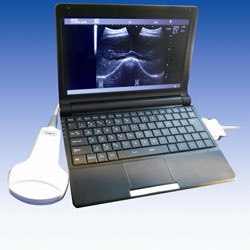 Digital Mobile Ultrasonic Diagnostic System