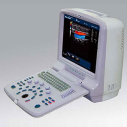 Portable Color Doppler Ultrasound Scanner